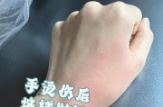 华为手环9低温烫伤是为什么？如何避免这种情况发生？