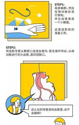 手机呼吸支架的用途是什么？如何正确使用？