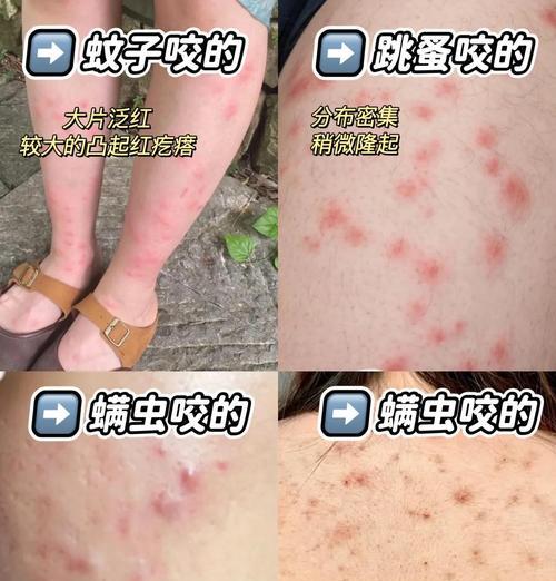 手机摄像头进虫子怎么清理？有哪些预防措施？
