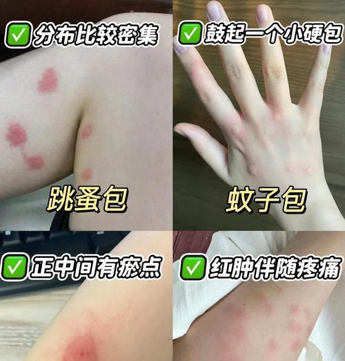 手机摄像头进虫子怎么清理？有哪些预防措施？