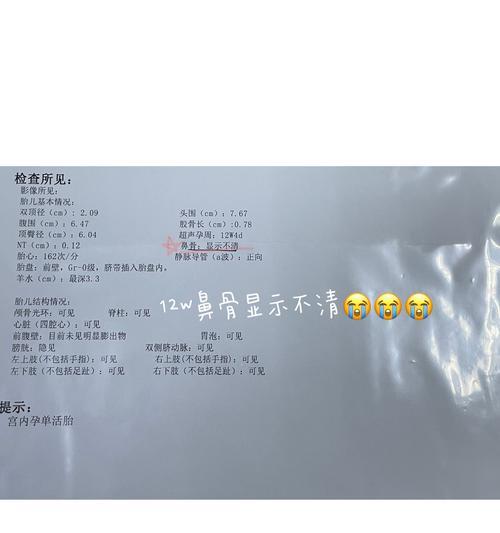显示屏上显示的nt是什么意思？遇到这种情况应该怎么办？