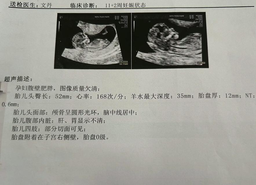 显示屏上显示的nt是什么意思？遇到这种情况应该怎么办？