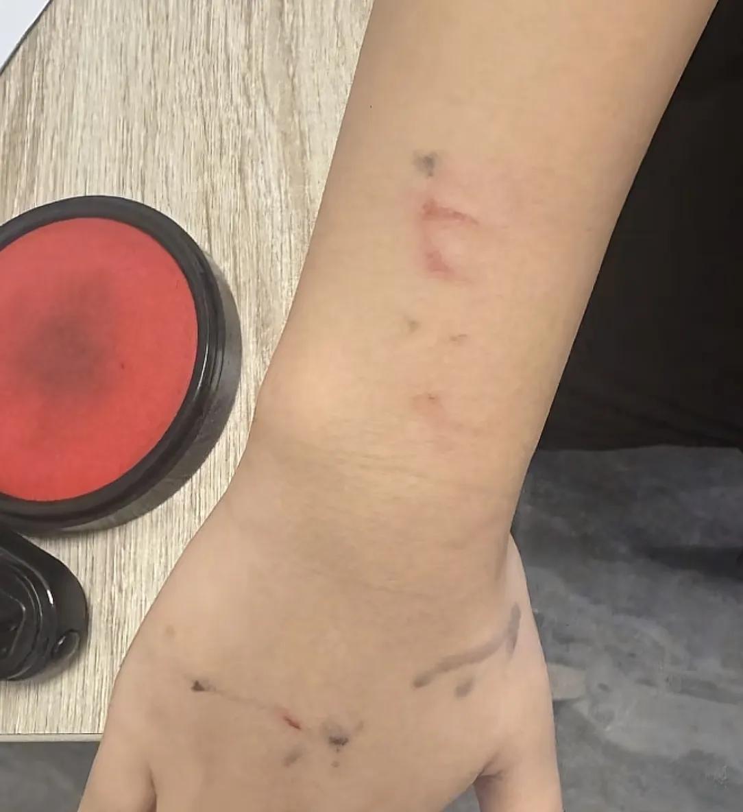 女子外卖代送被大妈抢单，手臂被掐伤！是个惯犯，年纪大管不了
