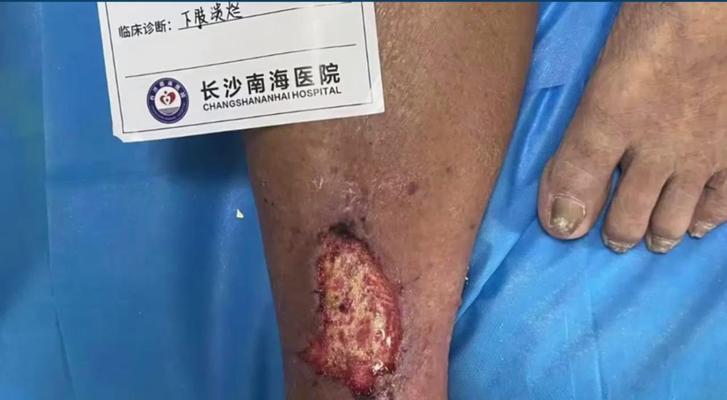 冰柜中滋生蛆虫的处理方法（消除冰柜蛆虫的有效技巧）