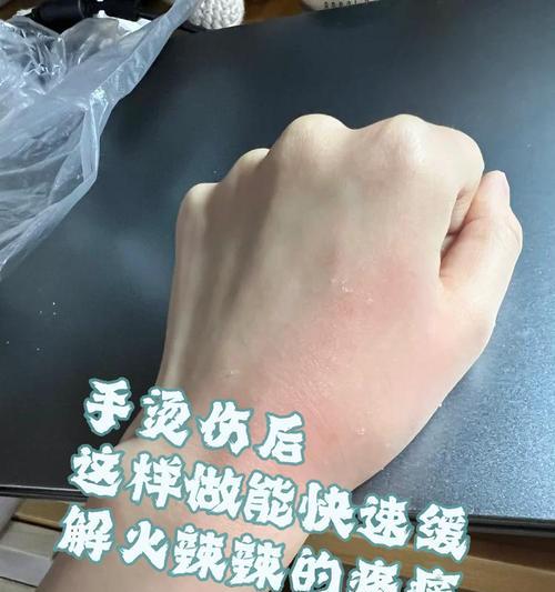 华为手环9低温烫伤是为什么？如何避免这种情况发生？